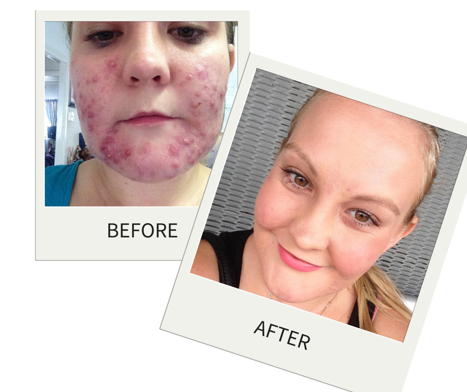 Krystyna's incredible before and after photos