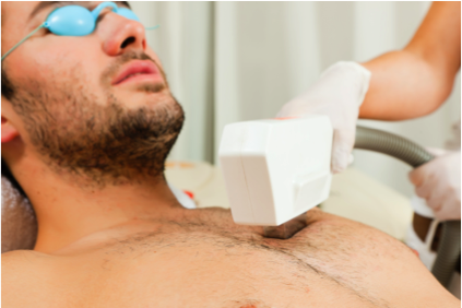 Male IPL Hair Removal - The smooth guys get the girls…