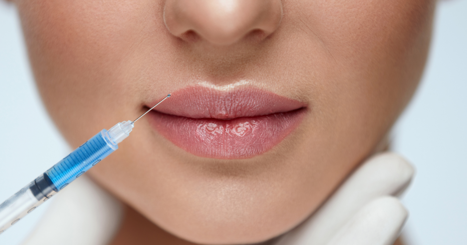 Everything You Need To Know About Injectable Lip Filler - Believe in ...